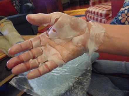 Waxed hand after